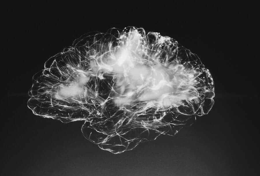 Brain Image